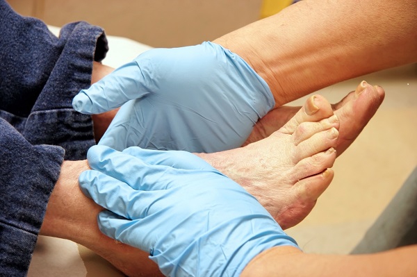 Diabetic Foot Care